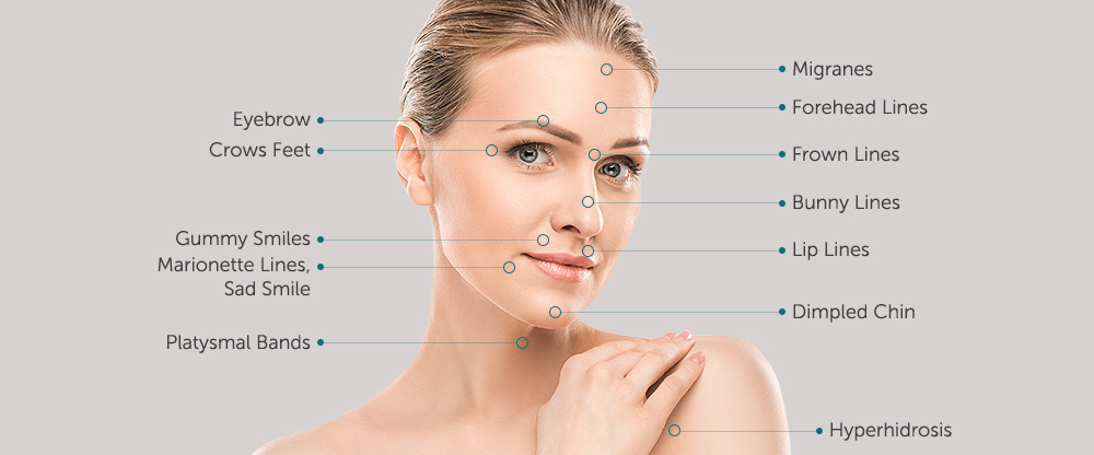 Different areas of Botox treatment