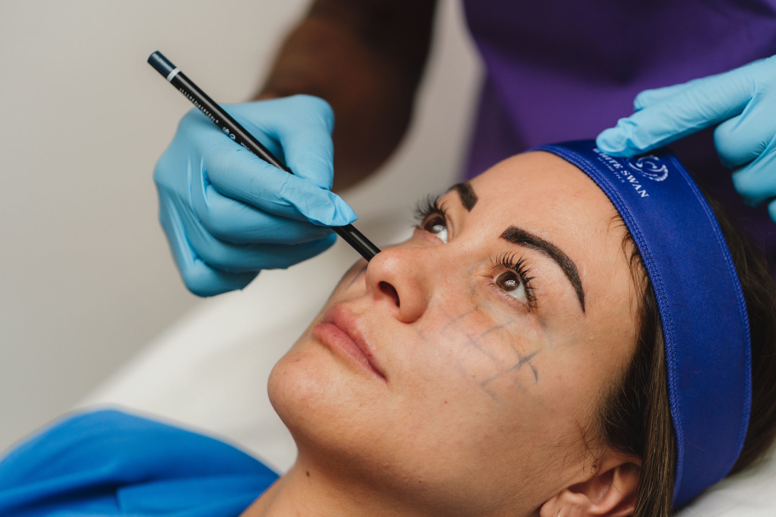 dermal filler page