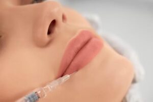 Lip Fillers In Guildford