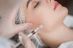 Skin Boosters in London