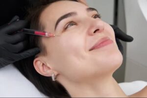 Tear Trough Fillers