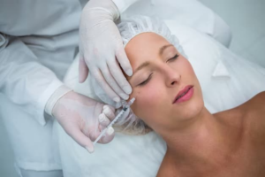 Botox treatment in Wimbledon